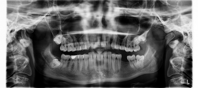 snímek zubů
